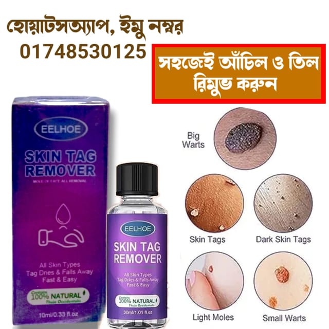 Skin Tag Removr | আঁচিল রিমুভার_img_0